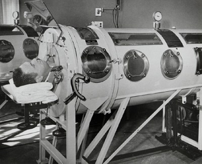 The iron lung, the technology that kept many polio patients alive. Courtesy of the Smithsonian Institution