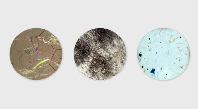 Microfibers from clothing. Courtesy of Microfiber blog and Patagonia